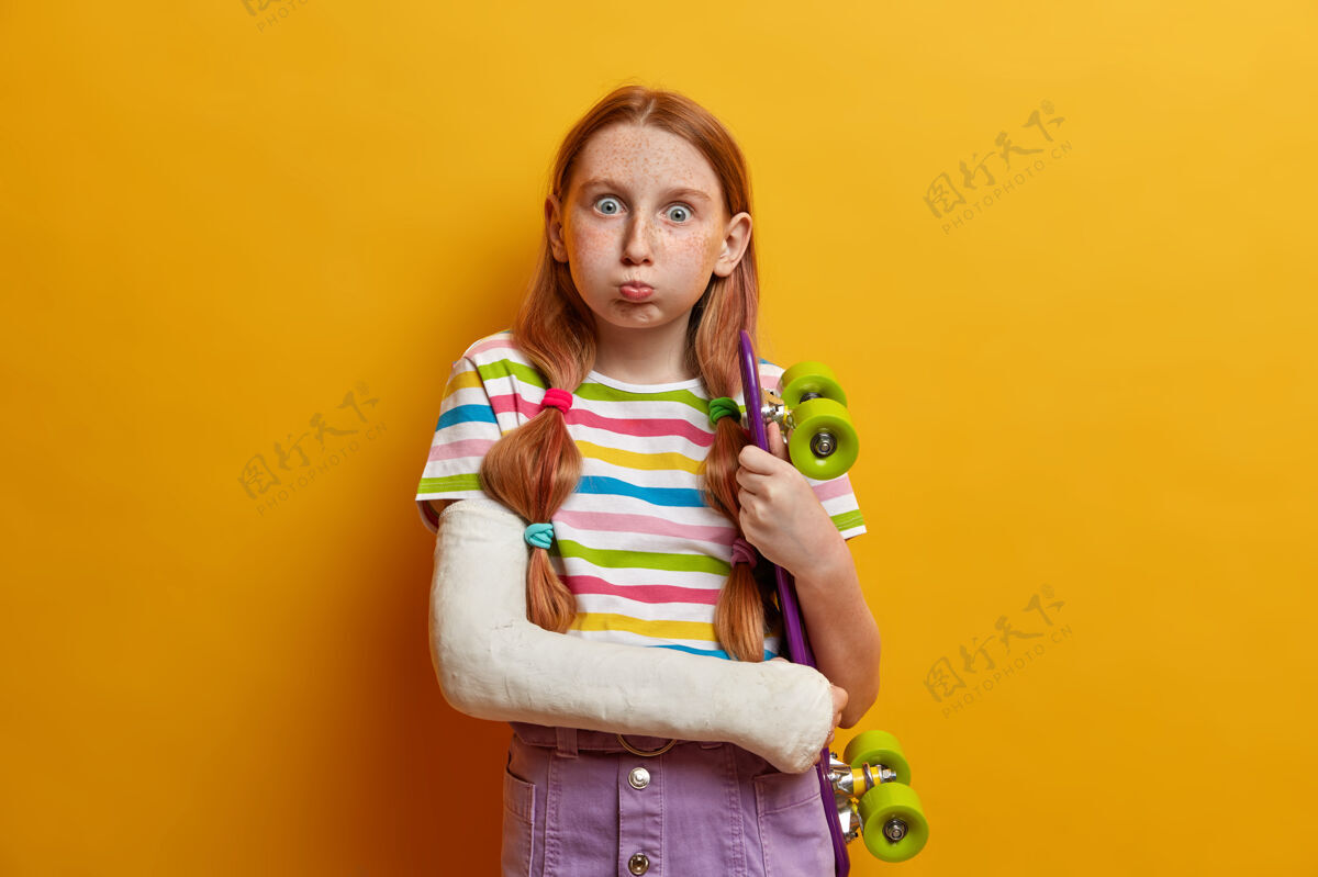 受伤孩子 爱好 消遣的概念红发女孩吹脸颊和凝视 有雀斑皮肤姿势与滑板穿上石膏断臂隔离在黄色的墙壁不幸的滑板吹事故撅嘴