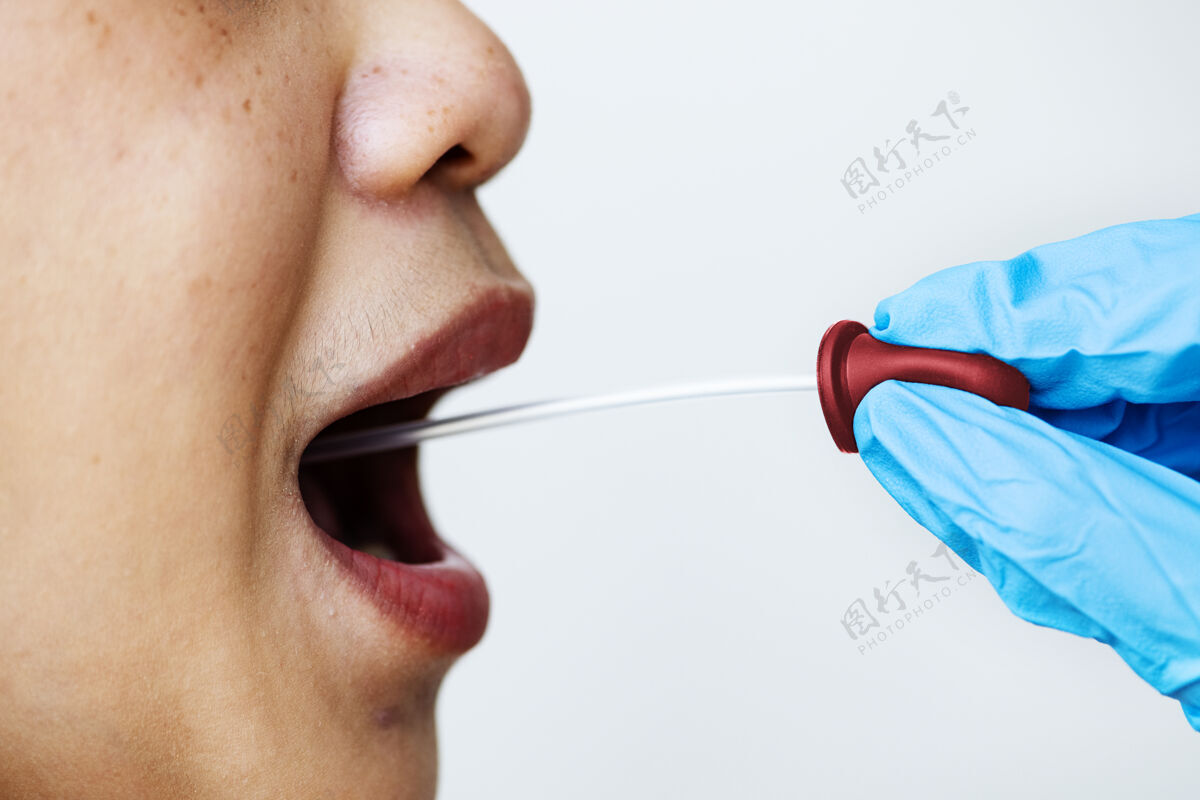 治疗一个女人正在用嘴拭子检测冠状病毒测试安全安全
